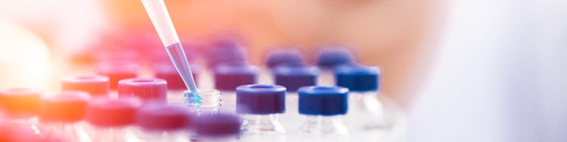 Liquid being poured into a plastic funnel by a shell scientist in a laboratory